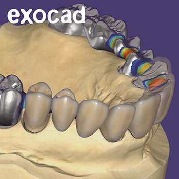 exocad2